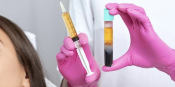 CDC “무면허 업소 미용시술 받고 HIV 감염”